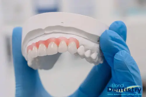 Flexible, metal, acrylic or combination dentures at Bondi Dentistry - your local family dentist in the heart of Bondi Beach