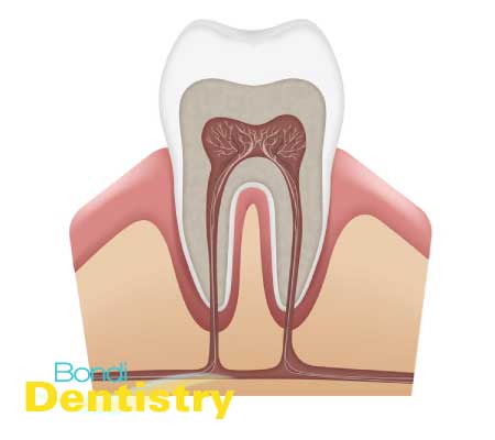 root canal therapy at Bondi Family Dentistry