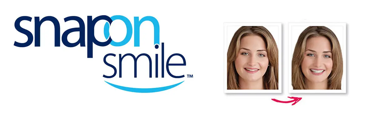 snap on smile available from Bondi Dentistry