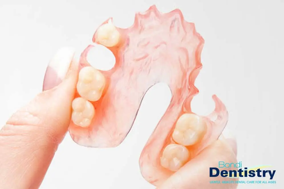 Flexible, metal, acrylic or combination dentures at Bondi Dentistry - your local family dentist in the heart of Bondi Beach